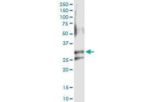 Immunoprecipitation (IP) image for anti-rho GDP Dissociation Inhibitor (GDI) alpha (ARHGDIA) (AA 1-204) antibody (ABIN513488)