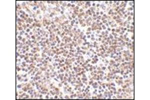 Immunohistochemistry of lipe in human lymph node tissue with this product at 2. (LIPE 抗体  (C-Term))
