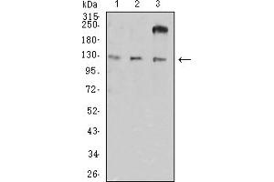 Western blot analysis using CD11a mouse mAb against HL-60 (1), A549 (2), and SW620 (3) cell lysate.