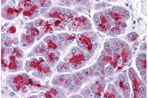 Human Pancreas: Formalin-Fixed, Paraffin-Embedded (FFPE) (ELOVL7 抗体  (N-Term))