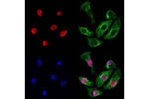 ABIN6260310 and ABIN6272938 staining Hela cells by IF/ICC. (BRD7 抗体  (Internal Region))