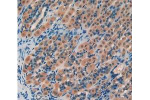 Used in DAB staining on fromalin fixed paraffin- embedded stomach tissue (PROS1 抗体  (AA 416-646))