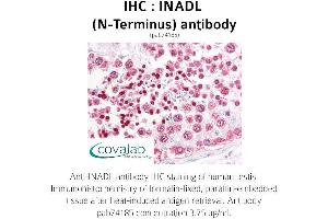 Image no. 1 for anti-InaD-Like (INADL) (N-Term) antibody (ABIN1735910) (PATJ 抗体  (N-Term))