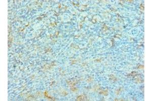 Immunohistochemistry of paraffin-embedded human tonsil tissue using ABIN7167157 dilution 1:100 (G3BP1 抗体  (AA 227-466))