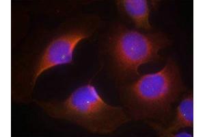 Immunofluorescence staining of methanol-fixed Hela cells using CDK6(phospho-Tyr13) Antibody. (CDK6 抗体  (pTyr13))