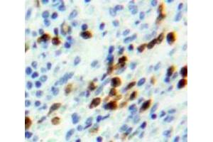 Used in DAB staining on fromalin fixed paraffin-embedded Spleen tissue (NUP107 抗体  (AA 554-784))