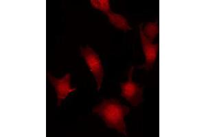 ABIN6267032 staining Hela by IF/ICC. (FER 抗体  (C-Term))