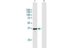 Western Blot analysis of RP2 expression in transfected 293T cell line by RP2 MaxPab polyclonal antibody. (RP2 抗体  (AA 1-350))