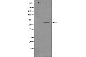 Western blot analysis of extracts from COLO cells using SLC22A3 antibody. (SLC22A3 抗体  (Internal Region))