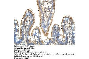 Rabbit Anti-KARS Antibody  Paraffin Embedded Tissue: Human Intestine Cellular Data: Epithelial cells of intestinal villas Antibody Concentration: 4. (KARS 抗体  (C-Term))