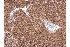 Image no. 2 for anti-Density-Regulated Protein (DENR) (AA 1-198) antibody (ABIN1501885) (Density Regulated Protein 抗体  (AA 1-198))