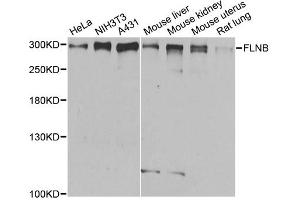 Western blot analysis of extracts of various cell lines, using FLNB antibody.