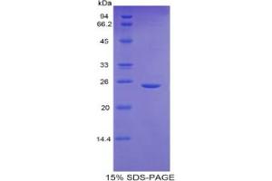 SDS-PAGE analysis of Mouse GCLC Protein. (GCLC 蛋白)