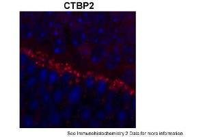 Sample Type: outer mouse plexiform layerRed: PrimaryBlue: DAPIPrimary Dilution: 1:200Secondary Antibody: Goat anti-Rabbit AF568 IgG(H+L)Secondary Dilution: 1:200Image Submitted by: David ZenisekYale University (CTBP2 抗体  (C-Term))