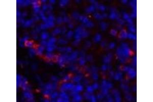 Immunofluorescence analysis of Rat spleen tissue using HSPA5 Polyclonal Antibody at dilution of 1:200.