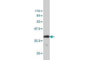Western Blotting (WB) image for anti-Centrin, EF-Hand Protein, 3 (CETN3) (AA 1-100) antibody (ABIN560341)