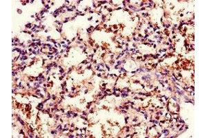 Immunohistochemistry of paraffin-embedded human lung tissue using ABIN7171408 at dilution of 1:100 (CD96 抗体  (AA 306-395))