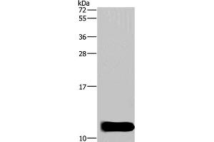 Western Blot analysis of Mouse brain tissue using DYNLL1 Polyclonal Antibody at dilution of 1:600