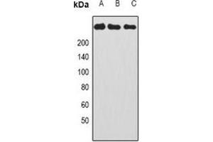 Western blot analysis of CAD expression in HepG2 (A), Hela (B), HL60 (C) whole cell lysates. (CAD 抗体)