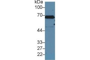 Detection of CK2 in Human A431 cell lysate using Polyclonal Antibody to Keratin 2 (CK2)