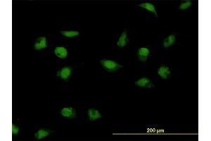 Immunofluorescence of monoclonal antibody to CNOT3 on HeLa cell. (CNOT3 抗体  (AA 1-100))