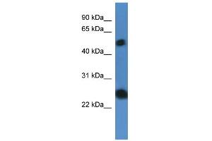 WB Suggested Anti-SLA2 Antibody Titration: 0. (SLAP2 抗体  (N-Term))