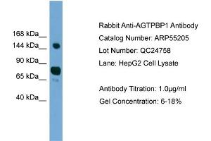WB Suggested Anti-AGTPBP1  Antibody Titration: 0. (AGTPBP1 抗体  (N-Term))