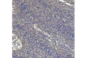 IHC analysis of G-CSF/CSF3 using anti-G-CSF/CSF3 antibody (ABIN3042762). (G-CSF 抗体  (AA 38-207))