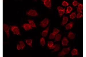 ABIN6267390 staining Hela by IF/ICC. (ATF2 抗体  (pThr53, pThr71))