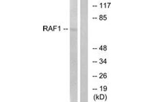 Western blot analysis of extracts from HeLa cells, treated with UV 5', using C-RAF (Ab-621) Antibody. (RAF1 抗体  (AA 591-640))