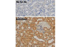 Immunohistochemistry (IHC) image for anti-Cadherin 1, Type 1, E-Cadherin (Epithelial) (CDH1) antibody (ABIN6254215) (E-cadherin 抗体)