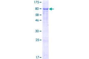Image no. 1 for gamma Glutamyltransferase 1 (GGT1) (AA 1-569) protein (GST tag) (ABIN7477796)