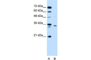 WB Suggested Anti-RCE1 Antibody Titration:  1. (RCE1/FACE2 抗体  (N-Term))