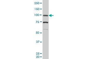PGR monoclonal antibody (M05), clone 1B11 Western Blot analysis of PGR expression in K-562 . (Progesterone Receptor 抗体  (AA 1-110))