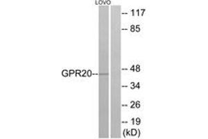 Western blot analysis of extracts from LOVO cells, using GPR20 Antibody. (GPR20 抗体  (AA 291-340))