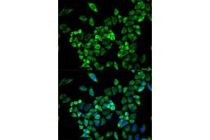 Immunofluorescence analysis of A549 cell using AOC3 antibody. (AOC3 抗体  (AA 27-190))