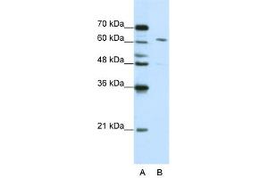 WB Suggested Anti-CPSF6 Antibody Titration:  0. (CPSF6 抗体  (Middle Region))