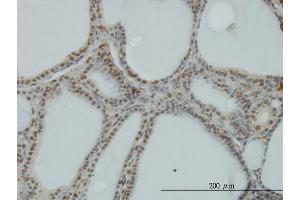 Immunoperoxidase of monoclonal antibody to POLR1C on formalin-fixed paraffin-embedded human thyroid nodular goiter. (POLR1C 抗体  (AA 1-346))