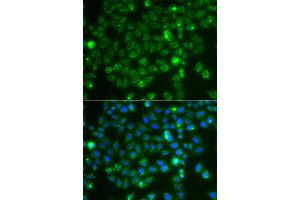 Immunofluorescence analysis of A549 cells using RAC1 antibody. (RAC1 抗体)