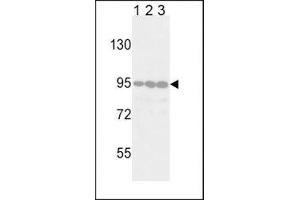 Western blot analysis of DDR2 antibody in Jurkat (lane 1), 293 (2) and HeLa (3) lysate. (DDR2 抗体)