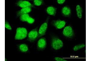 Immunofluorescence of monoclonal antibody to E4F1 on HeLa cell. (E4F1 抗体  (AA 685-784))