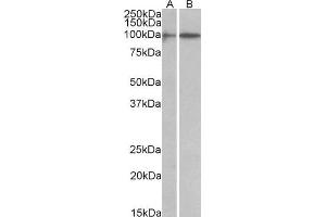 ABIN1590055 (1 µg/mL) staining of A549 (A) and Jurkat (B) lysates (35 µg protein in RIPA buffer). (HIC1 抗体  (AA 193-204))