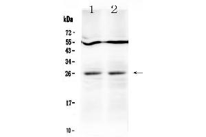 Western blot analysis of LIGHT  using anti-LIGHT  antibody . (TNFSF14 抗体  (AA 59-239))