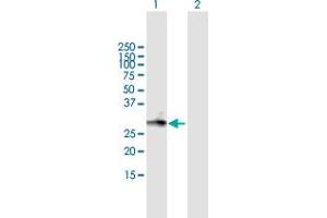 Western Blot analysis of MGC3036 expression in transfected 293T cell line by MGC3036 MaxPab polyclonal antibody. (LRRC61 抗体  (AA 1-259))