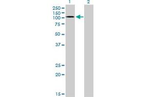 Western Blot analysis of EPHA3 expression in transfected 293T cell line by EPHA3 monoclonal antibody (M01), clone 3A12. (EPH Receptor A3 抗体  (AA 202-326))