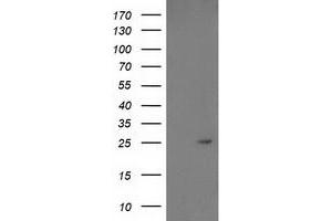 Western Blotting (WB) image for anti-Growth Differentiation Factor 15 (GDF15) antibody (ABIN1500100)