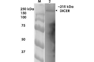 Western Blot analysis of Rat Brain Membrane showing detection of ~215 kDa Dicer protein using Mouse Anti-Dicer Monoclonal Antibody, Clone S167-7 . (DICER1 抗体  (AA 1638-1899) (Biotin))