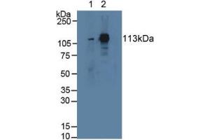 Western blot analysis of (1) Rat Serum and (2) Mouse Lung Tissue. (STAT2 抗体  (AA 587-838))