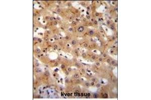 GGCX Antibody (Center) (ABIN655069 and ABIN2844699) immunohistochemistry analysis in formalin fixed and paraffin embedded human liver tissue followed by peroxidase conjugation of the secondary antibody and DAB staining. (GGCX 抗体  (AA 548-578))