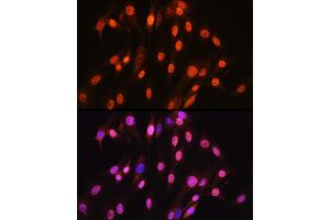 Immunofluorescence analysis of C6 cells using SOX10 Rabbit mAb (ABIN7270566) at dilution of 1:100 (40x lens). (SOX10 抗体)